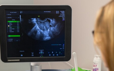Ultrasound 