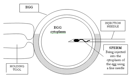 icsi process diagram