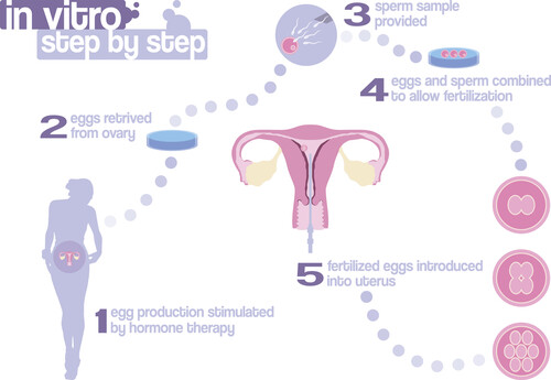 IVF Process