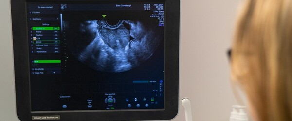 Ultrasound